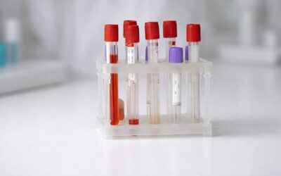CNAS decontează în 2026 consultații preventive și analize gratuite inclusiv pentru neasigurați