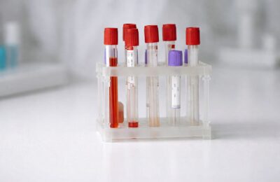 CNAS decontează în 2026 consultații preventive și analize gratuite inclusiv pentru neasigurați