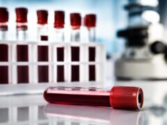 Un nou test de sânge pentru endometrioză a arătat o precizie de peste 95% în studiu
