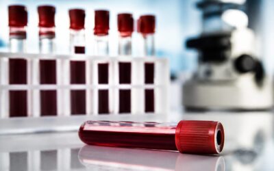 Un nou test de sânge pentru endometrioză a arătat o precizie de peste 95% în studiu