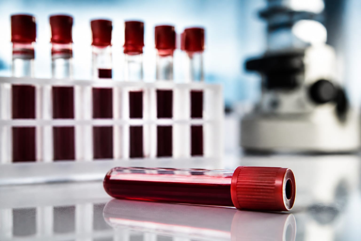 Un nou test de sânge pentru endometrioză a arătat o precizie de peste 95% în studiu